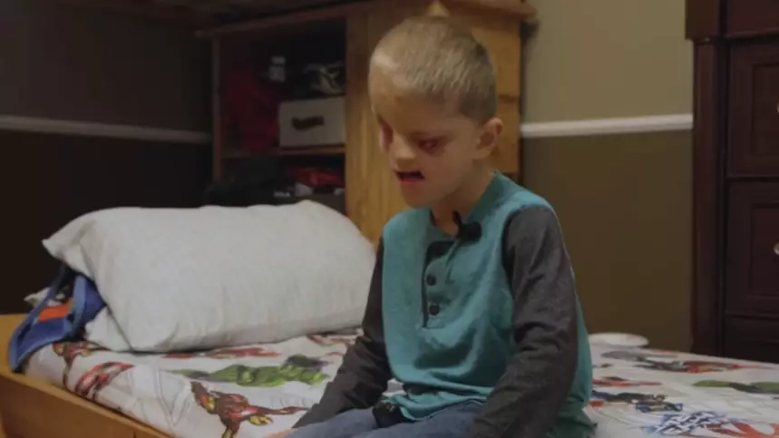 Six-Year-Old Boy One Of 60 In The World To Be Born With No Eyes