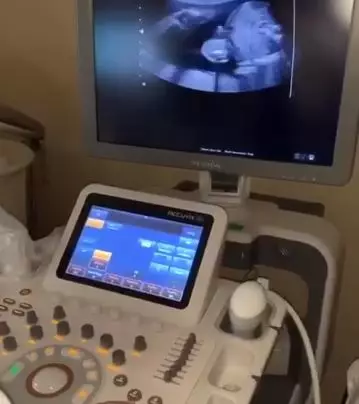 Part of the video showed the ultrasound scan.