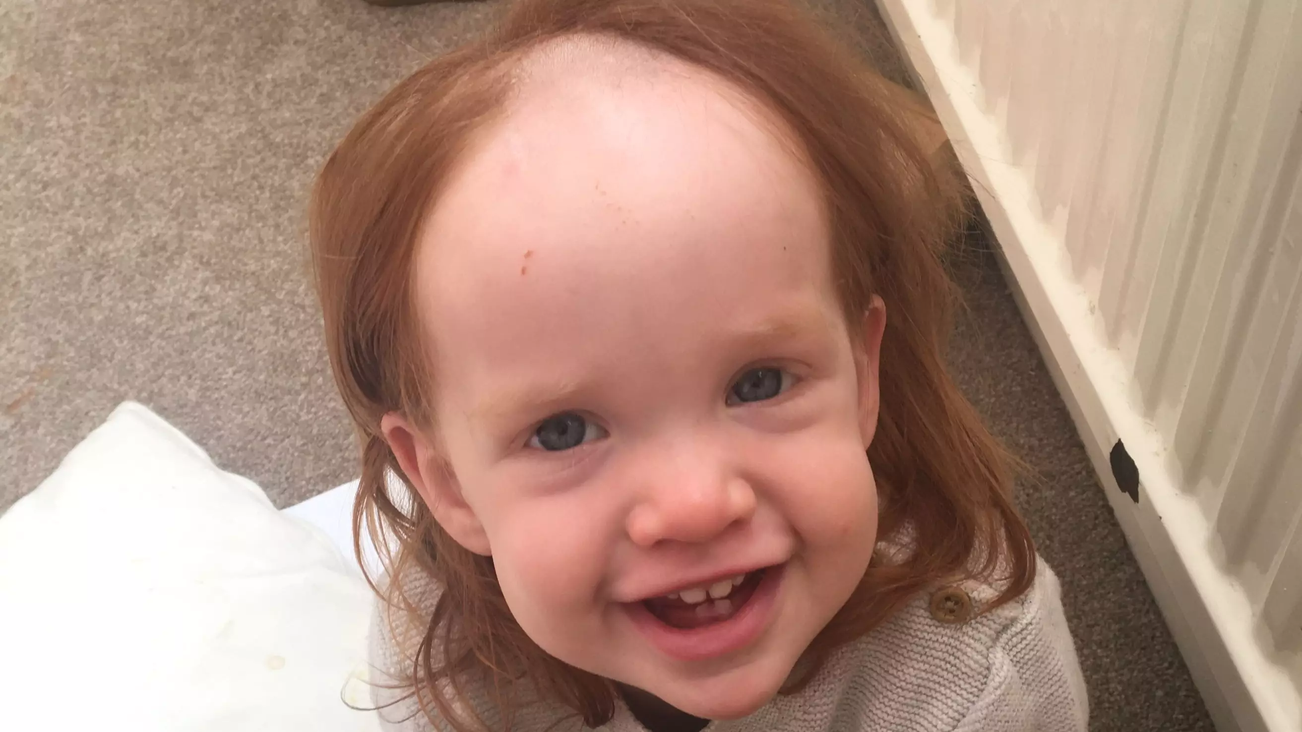 Little Girl Is Left Looking Like Pennywise After Stealing Hair Removal Cream