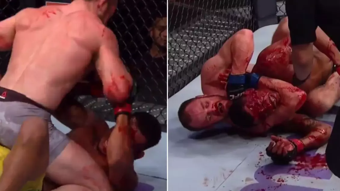 Alex 'Cowboy' Oliveira's Forehead Splits Open And Blood Squirts Everywhere After Brutal 'Hell-Bow'