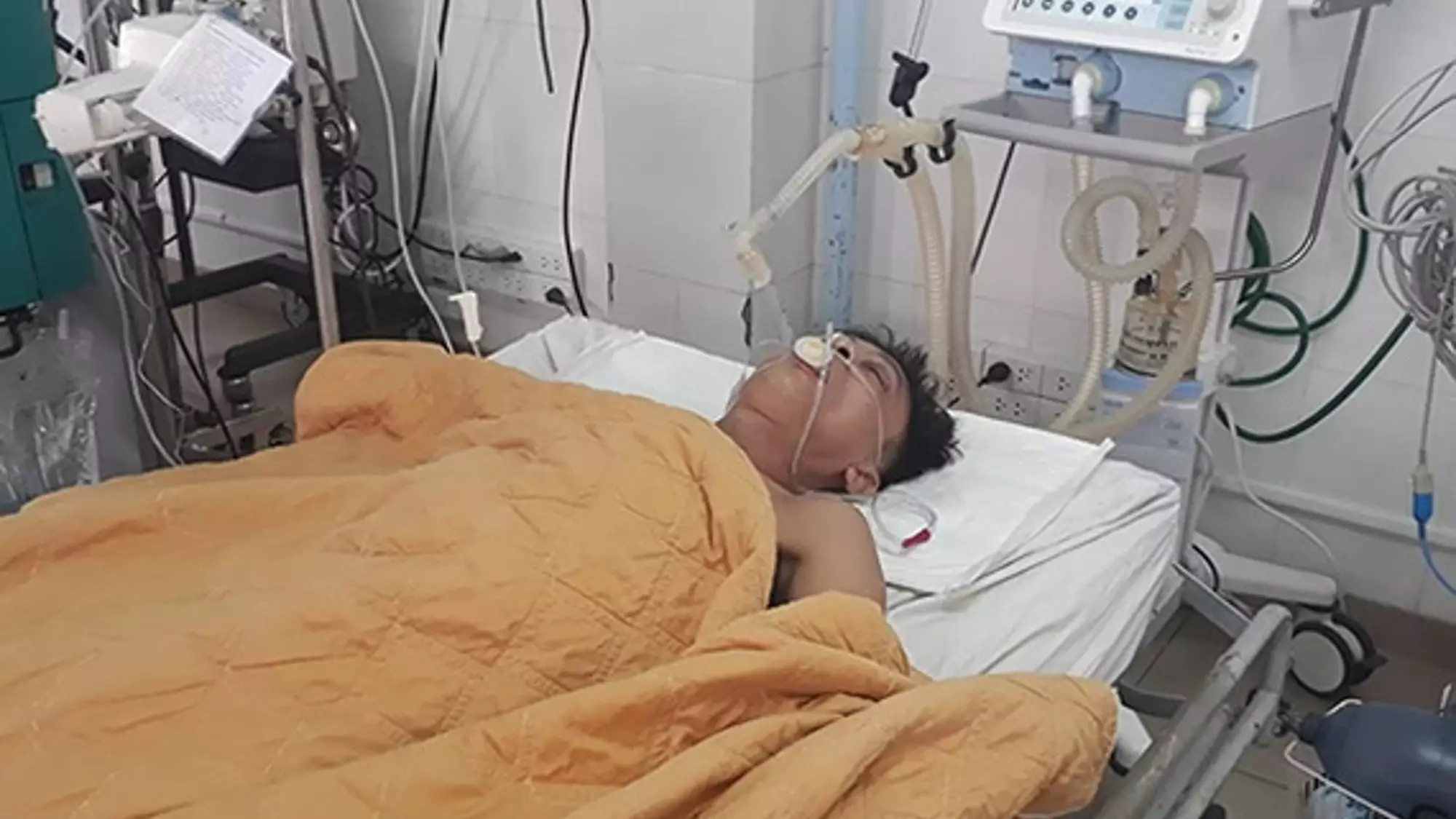 Doctors Save Man From Alcohol Poisoning By Administering 15 Cans Of Beer