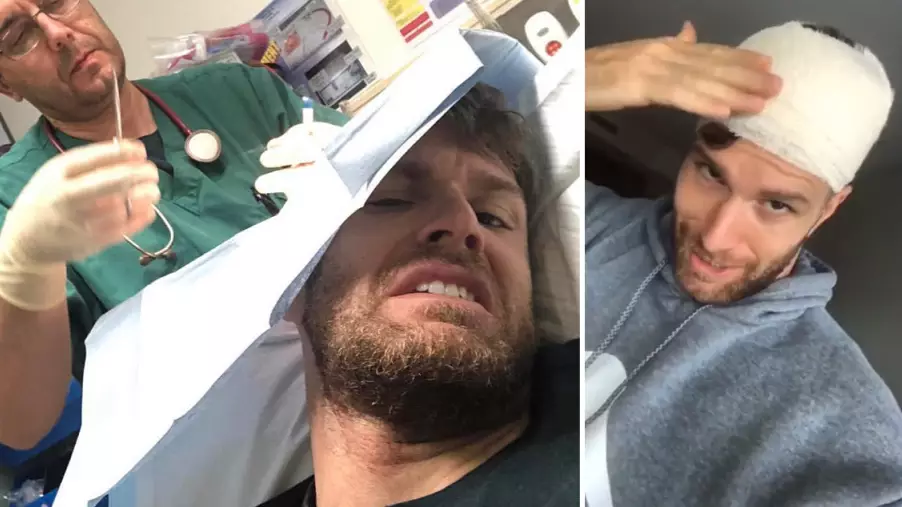 Joel Dommett Rushed To Hospital After I'm A Celebrity Set Crashes On His Head