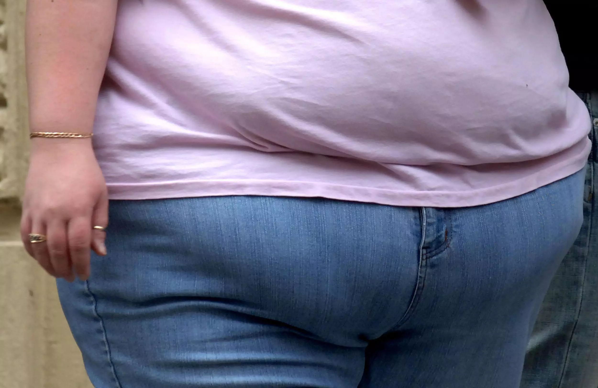Buerk says that obese people dying early would be making a 'selfless sacrifice'.