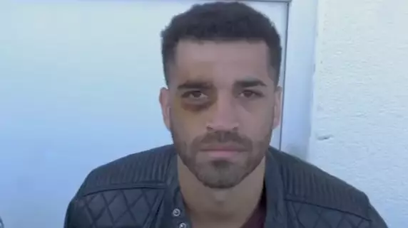Boxer Sam Maxwell Gives Himself Black Eye During Live Stream Uppercut Demonstration 