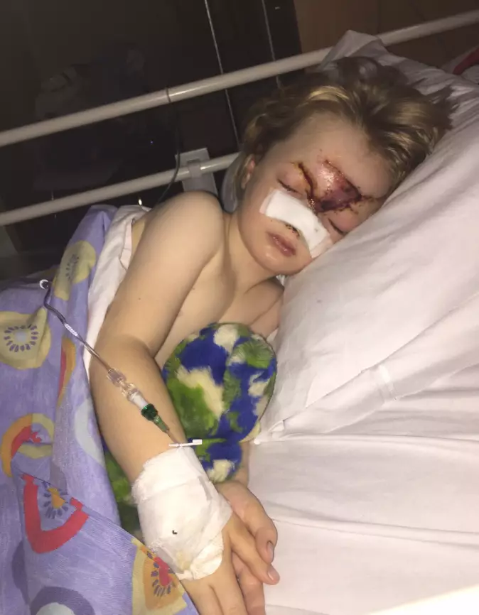 Charlie sustained serious facial injuries in a car crash.