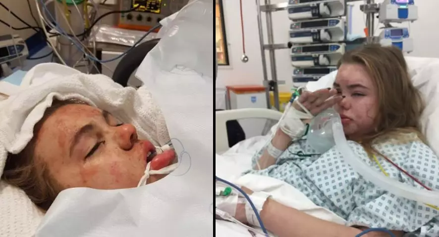 Mum Shares Photographs Of Daughter To Raise Awareness Of Dangers Of Ecstasy