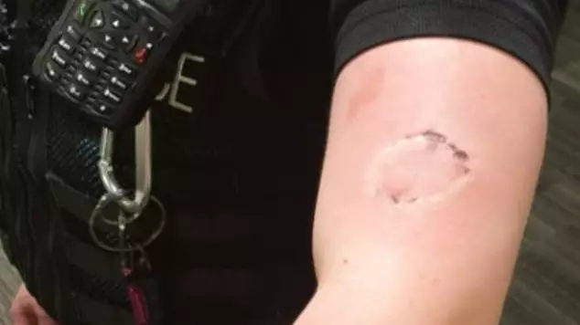 Police Officer Left With Teeth Marks On Arm After Being Bitten