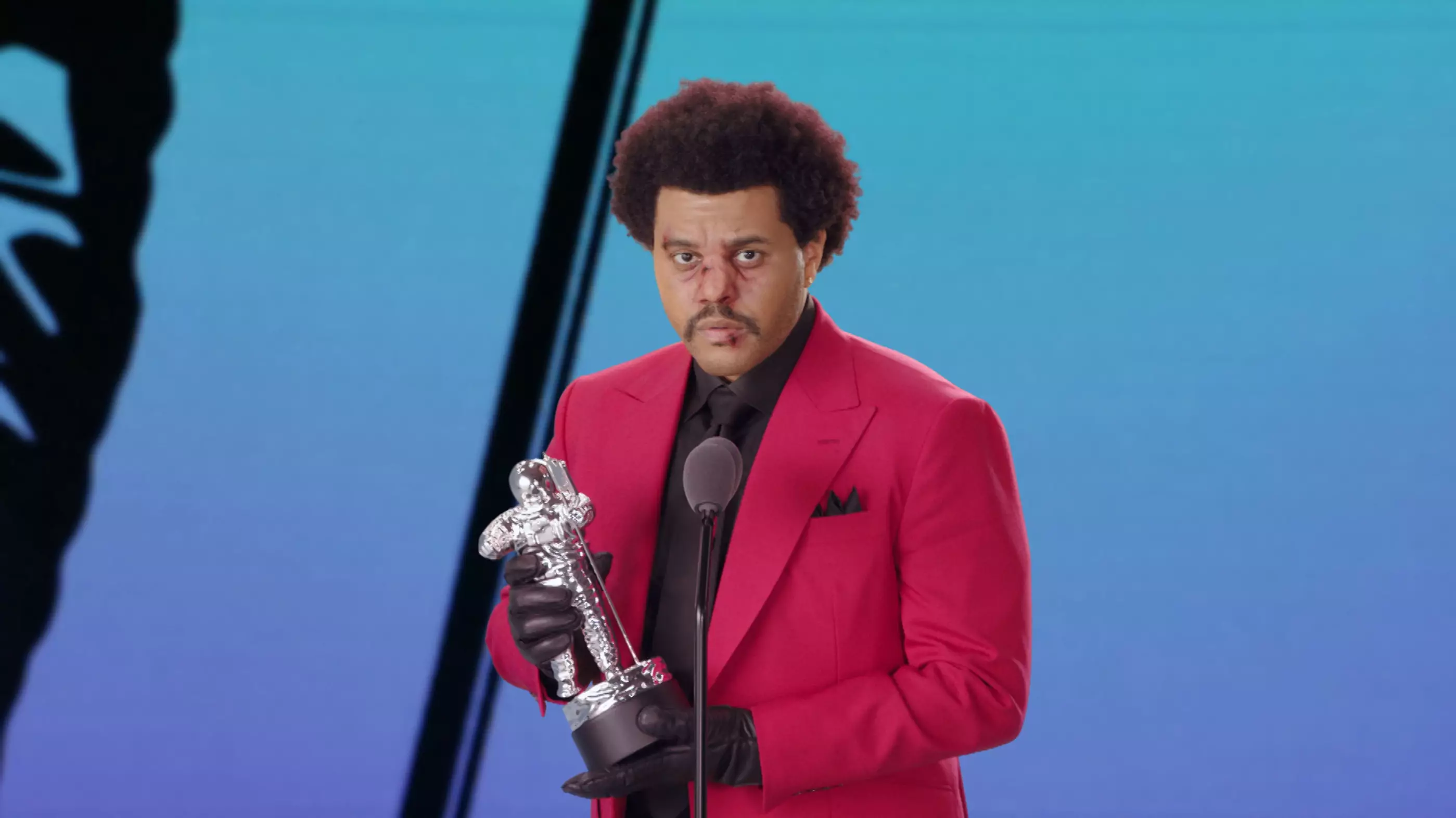 The Weeknd Looked Like He Got Beat Up At Video Music Awards