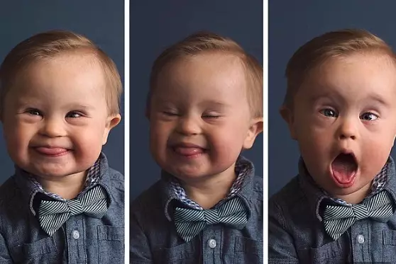 Mum Hits Back After Modelling Agency Rejects Her Down's Syndrome Son 