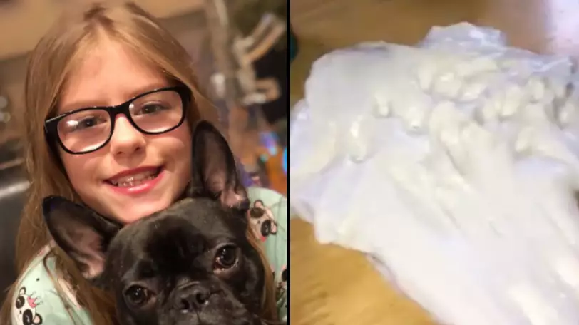 School Girl Suffers Chemical Burns After Following Homemade Slime Recipe