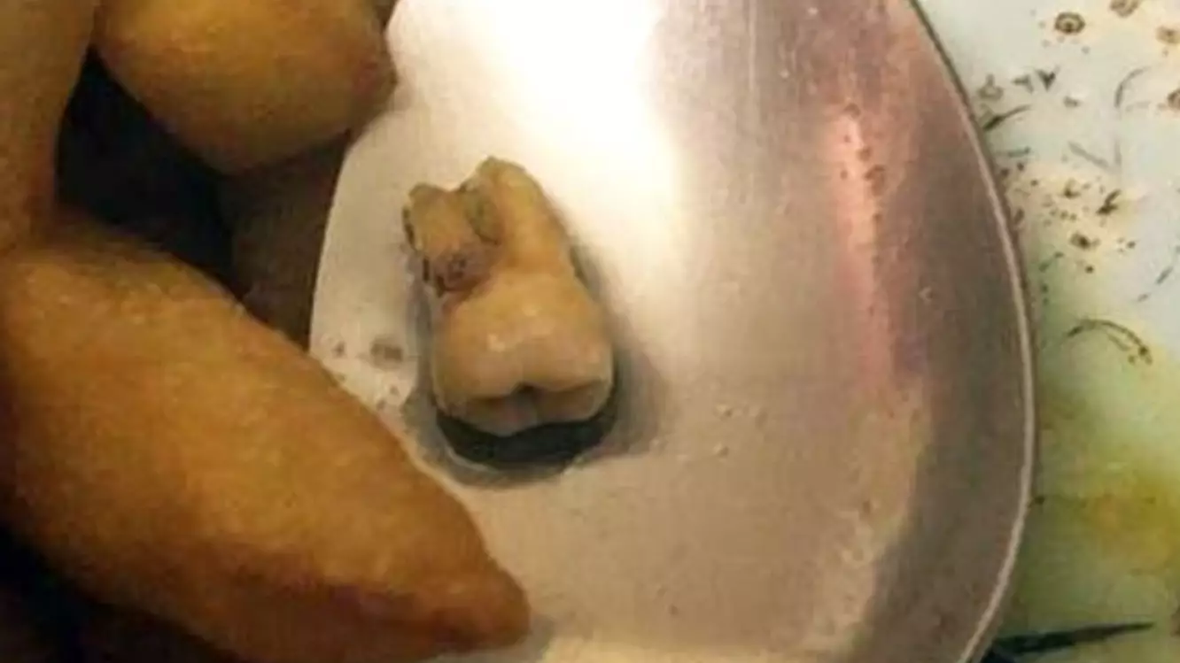 Chinese Takeaway Keeps Four Star Food Hygiene Rating After Molar Found In Curry 