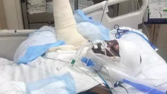 ​12-Year-Old Girl In Intensive Care After Attempting Viral ‘Fire Challenge’