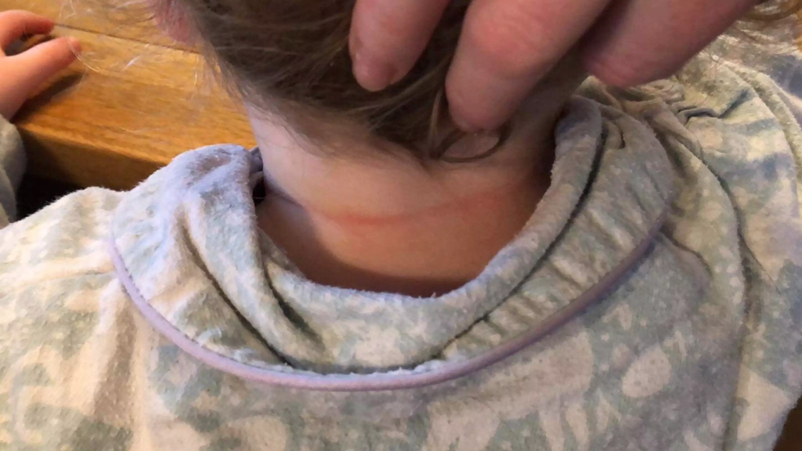 Mum Issues Urgent Warning After Daughter's Neck Is Trapped By Loose Thread On Bedding