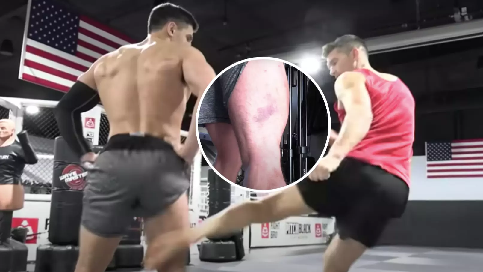 YouTuber's Hamstring Turns Blue After Brutal Leg Kicks From UFC Fighter