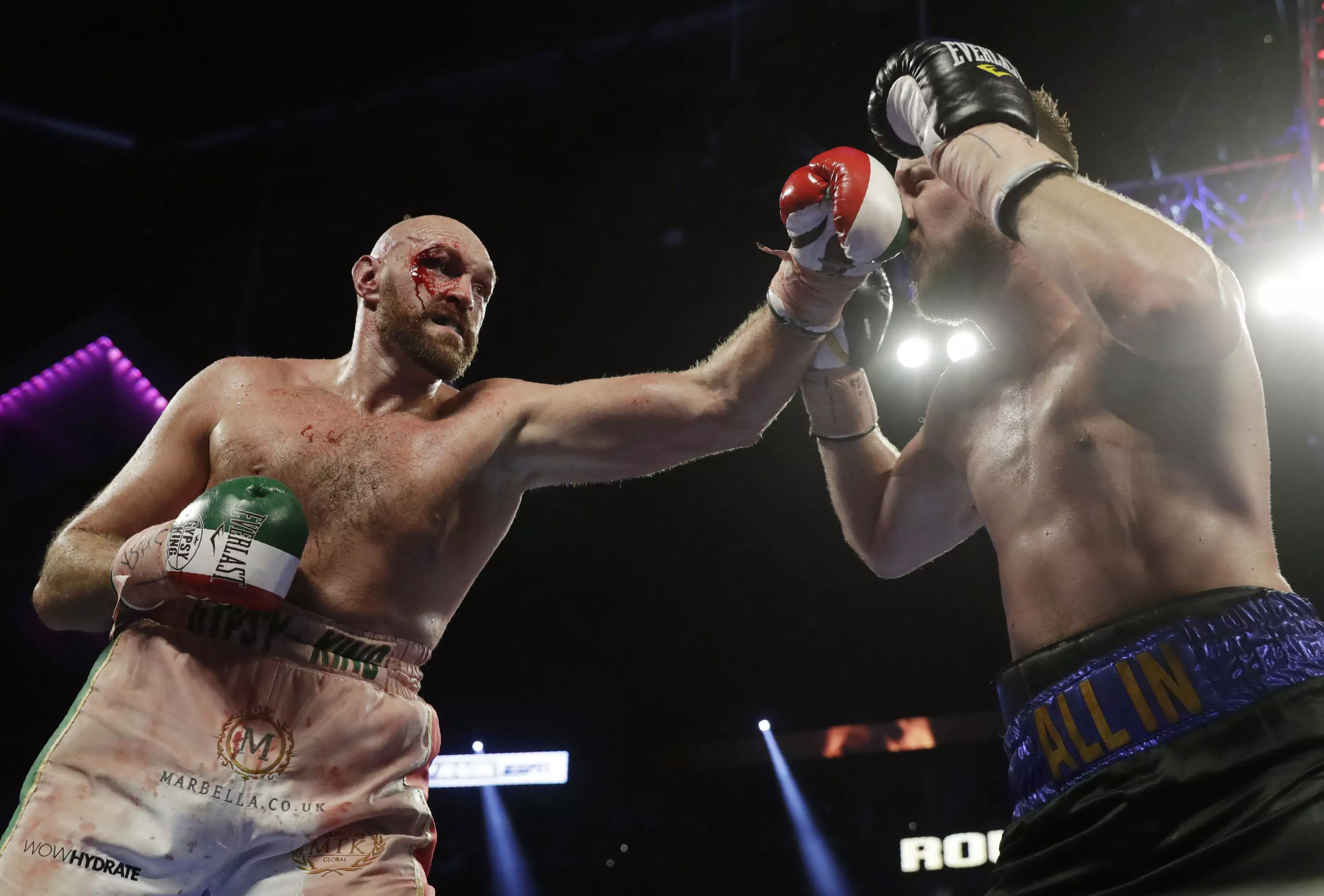 Fury suffered a nasty cut eye during his most recent fight in September. Image: PA Images