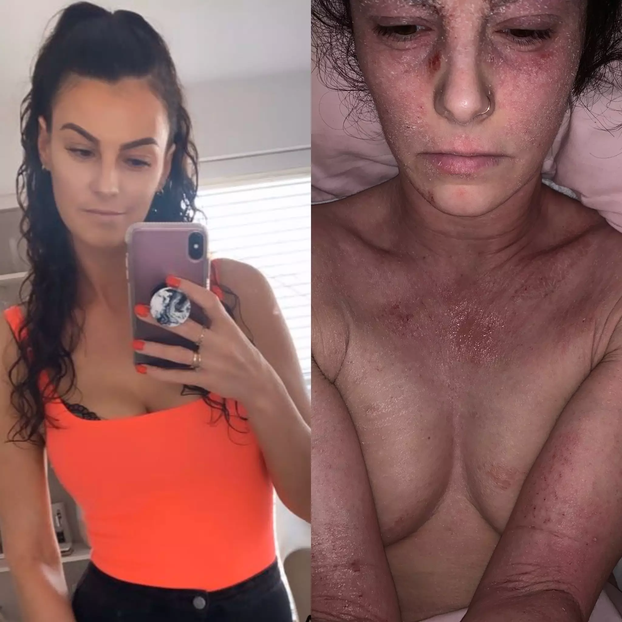 Stephanie is currently going through TSW, where she has cut out all steroids, beauty products and makeup (
