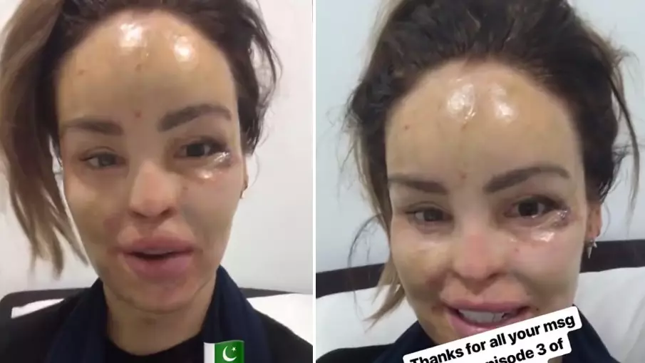 Katie Piper Is Recovering In Hospital In Pakistan Following Operation