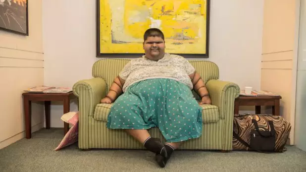 The World's Heaviest Teen Has Lost 10 Stone After Surgery