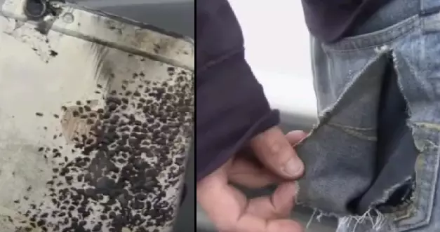 Student's iPhone Explodes In His Pocket And Sets Him On Fire