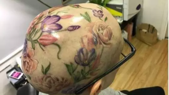 Woman With Alopecia Gets Amazing Flower Tattoo On Her Head