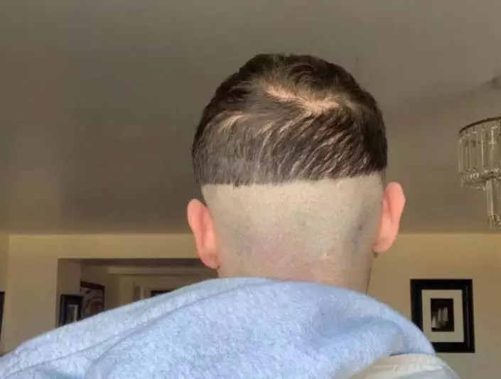 Matt was one of many who tried to get the perfect skin fade.