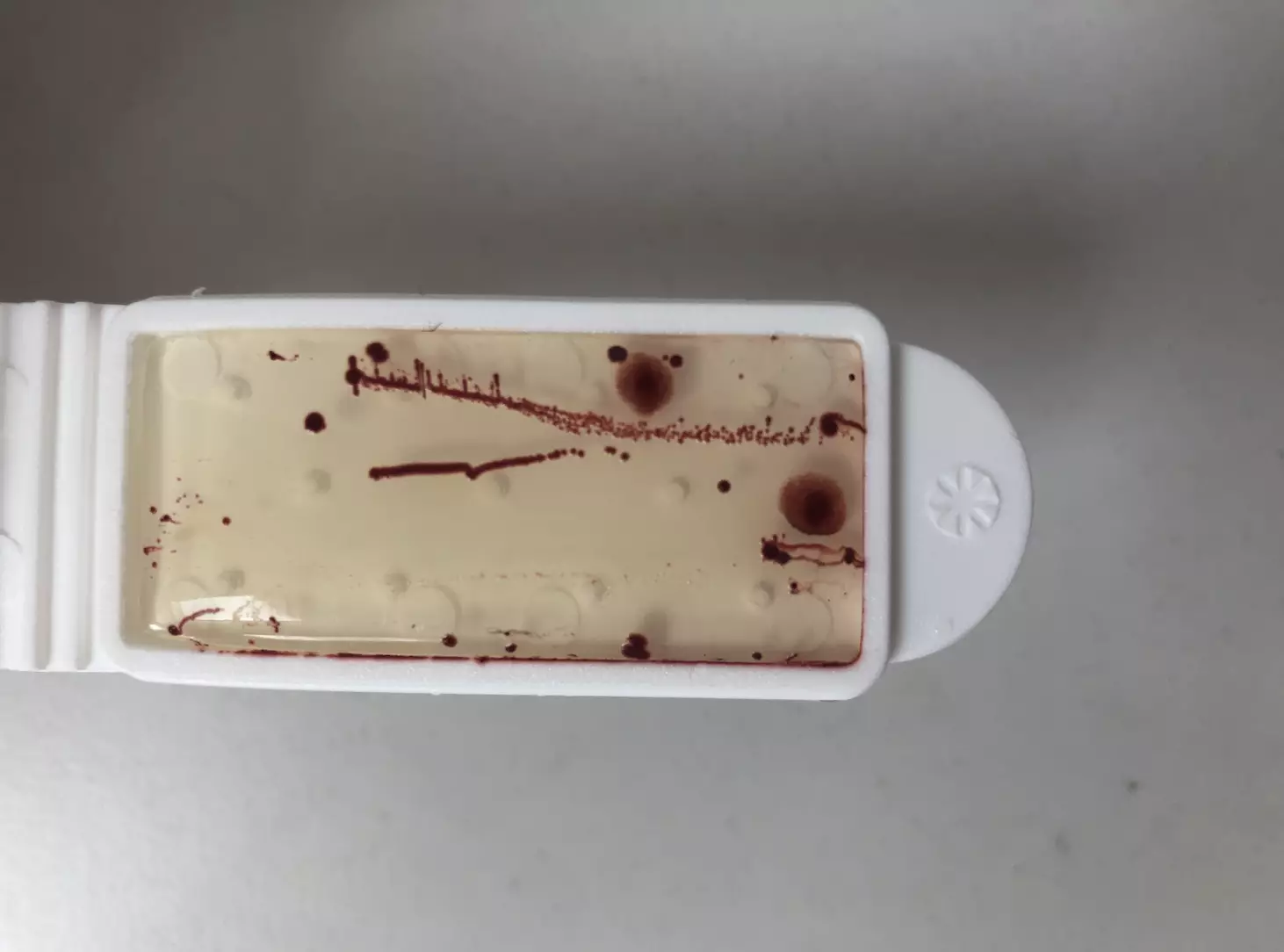 A swab showing the bacteria found on the driver's seat of a family car.