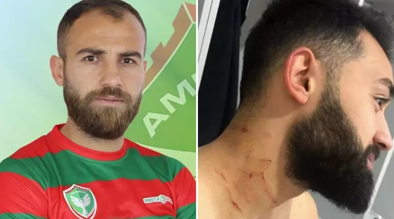 Mansur Çalar Receives Lifetime Ban From Football After Attacking Rival Player