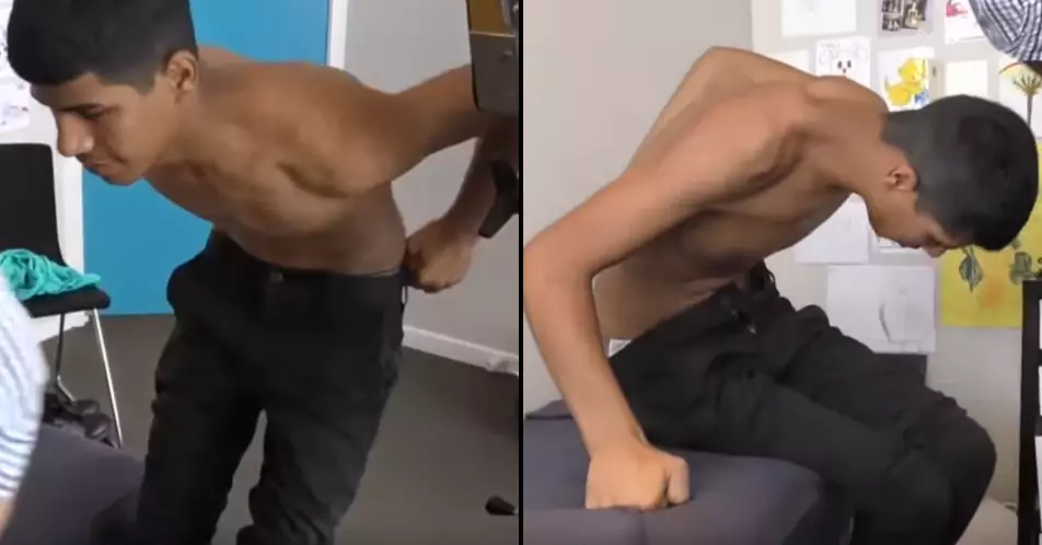 Chiropractor Completely Changes Teenager's Life With Amazing Back Cracking