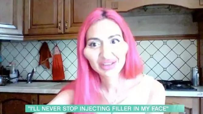 Woman Who Injects Fillers Into Own Face Says She's Getting More Romantic Attention Than Ever 
