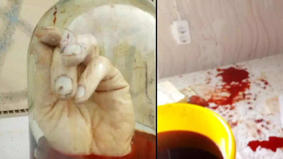 Man 'Cuts Off Hand And Places It In Jar' 