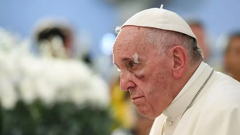 Pope Francis Suffers Black Eye During Papal Visit To Colombia