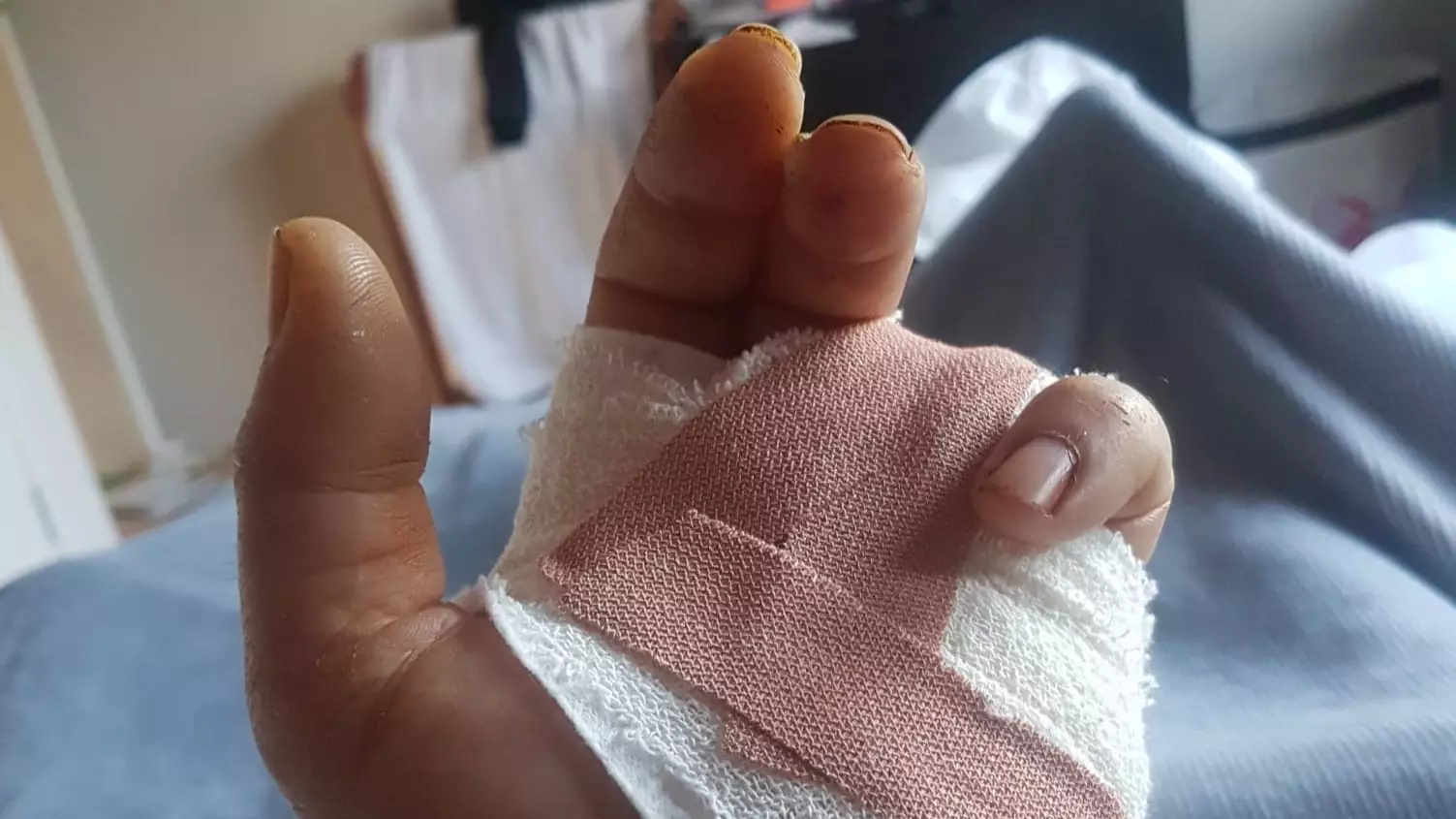 Aussie Says His Wedding Ring Ripped His Finger Clean Off After Nasty Fall