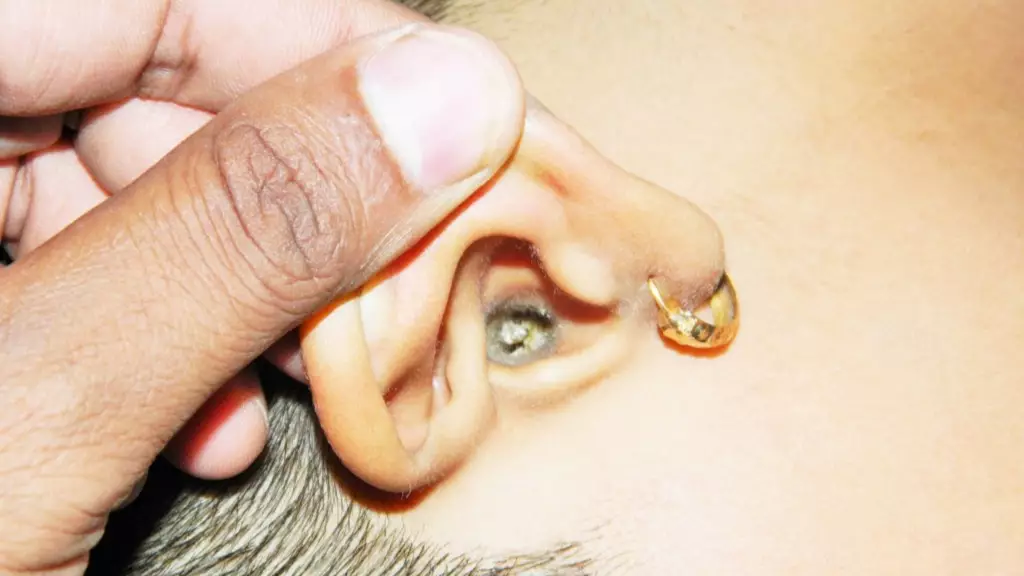 Can You Stomach This Video Of A Woman Getting Earwax Removed?