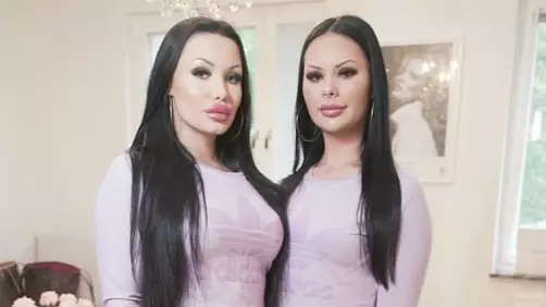 Two Pals Undergo Makeover To Look Like Twins 