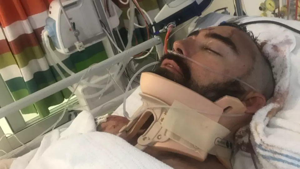 ​Heroic Dad Left Seriously Injured After Saving Son From Balcony Fall