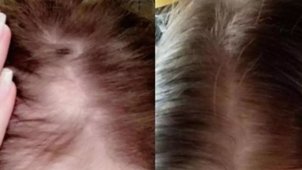 Customers Are Raving About 'Miracle' Hair Growth Shampoo That 'Actually Works'