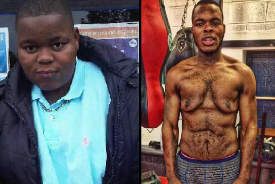 Lad Loses 15 Stone And Is Now Fundraising For Loose Skin Removal