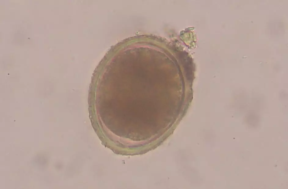 Roundworm (Toxocara cati) egg - photo taken through a microscope at 400x.