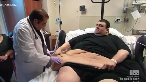 Man Who Weighed More Than 800 Pounds Dies Following Heart Attack