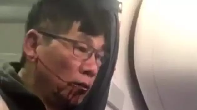 ​Doctor Dragged Off Plane Hires Two Lawyers