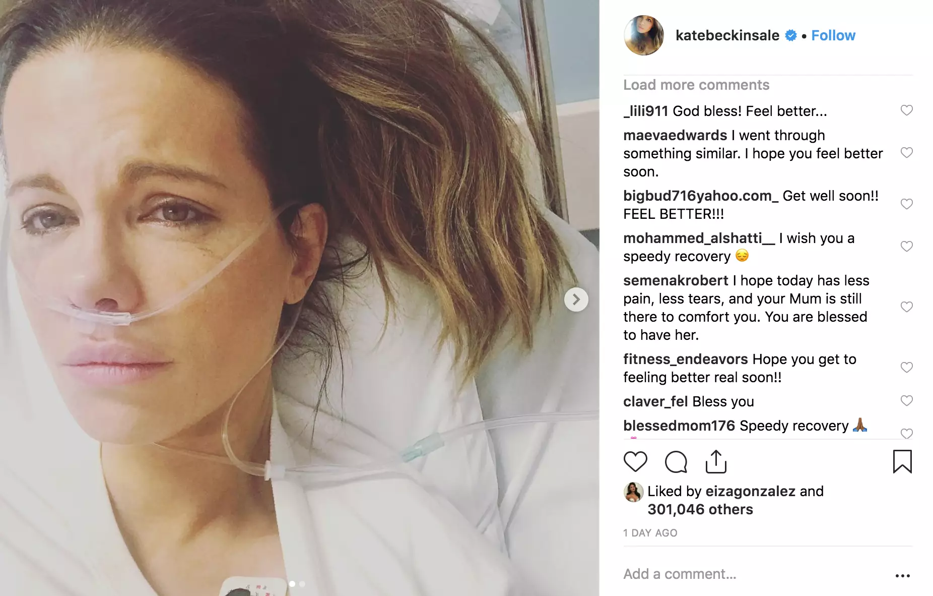 Kate Beckinsale, 45, wrote on Instagram that she suffered tremendous pain from ovarian cyst