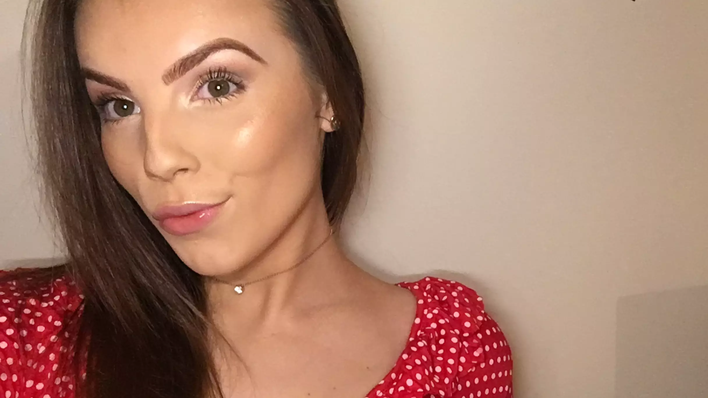 This Woman’s Eczema Was So Bad She Stayed Home For A Year