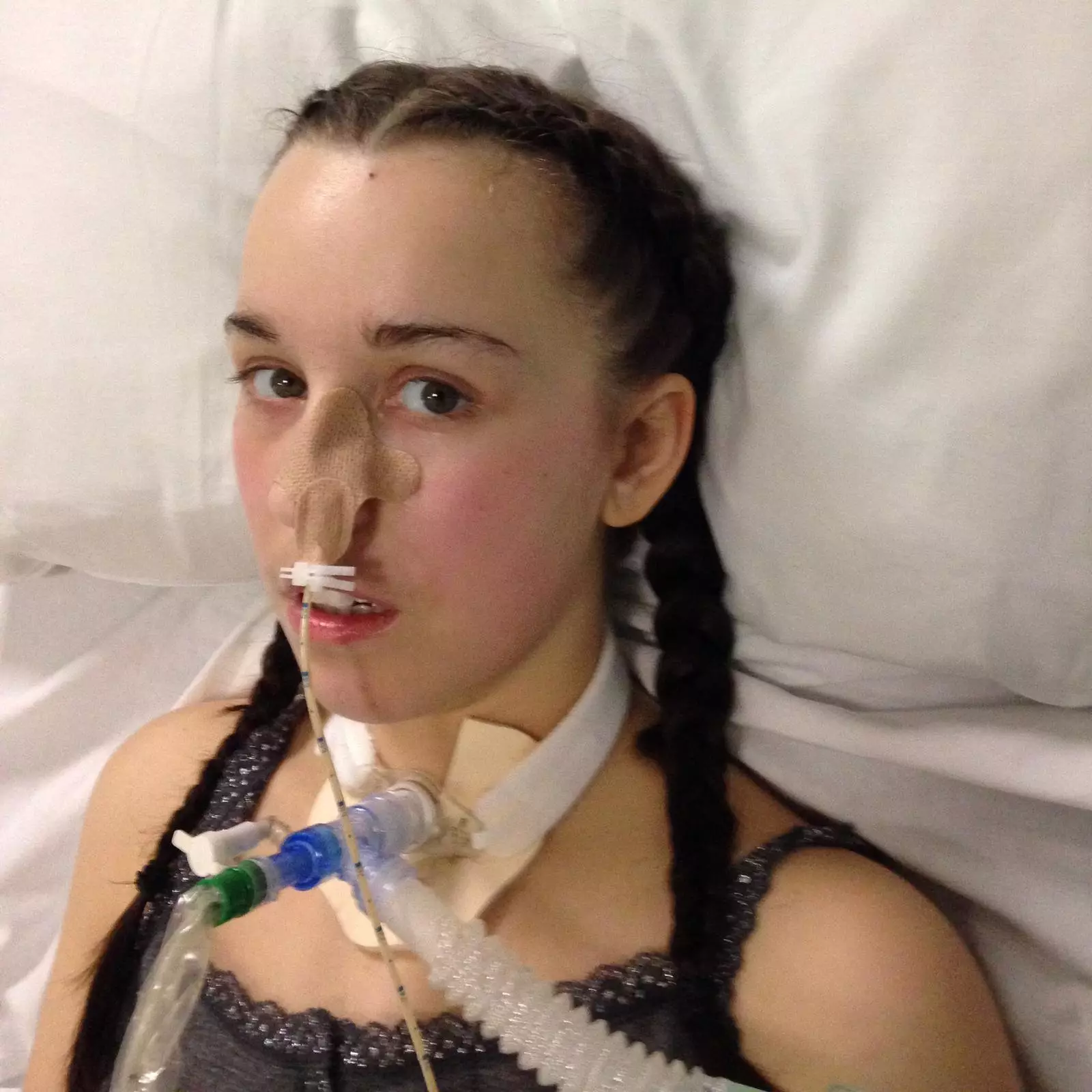 Rachael was placed on a ventilator just three days after symptoms first set in.