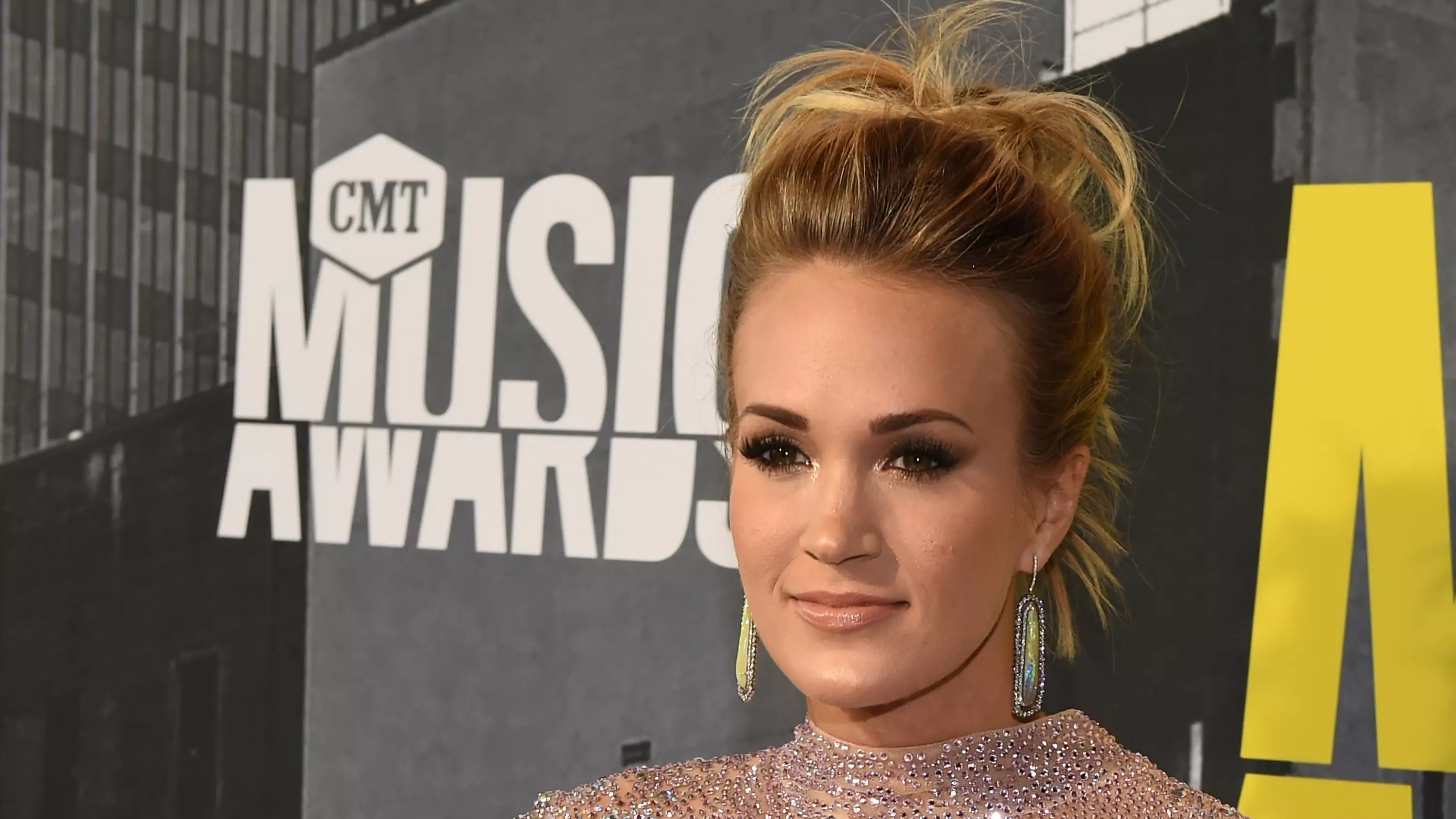 Carrie Underwood Tells Fans She Might 'Look A Bit Different' Following Fall 