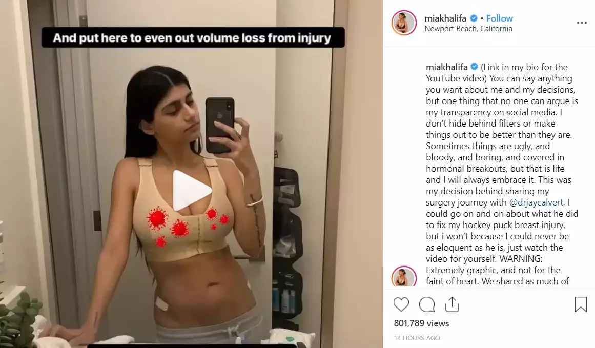 Mia Khalifa has shared her vlog following breast surgery.