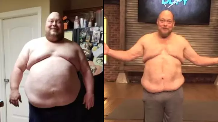Man Loses 198 Pounds In One Year And Looks Like A Different Person