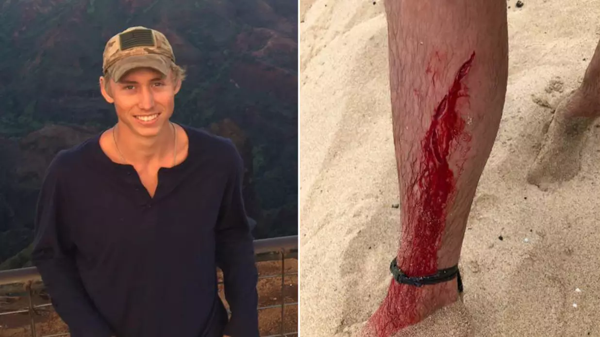 Maybe Stay Indoors? Man Bitten By Shark, Bear And Snake In The Space Of Four Years