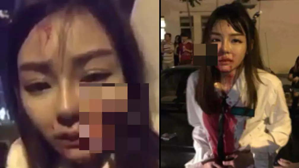 Woman Left With Knife Sticking Out Of Her Face After Attack 