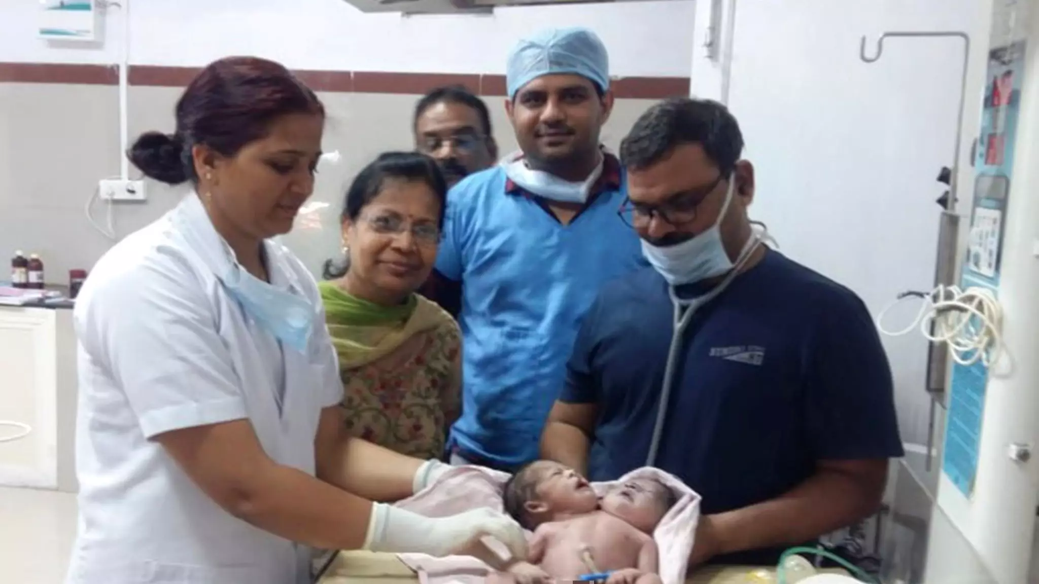 'Shocked' Couple Vow To Take Care Of Baby Born With Two Heads