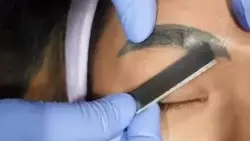 Woman Gets Botched Eyebrow Tattoos Removed